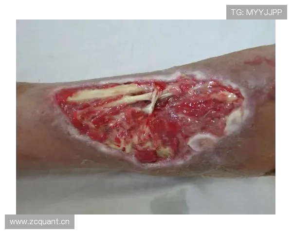 罗马皮西利赛前踝伤成疑